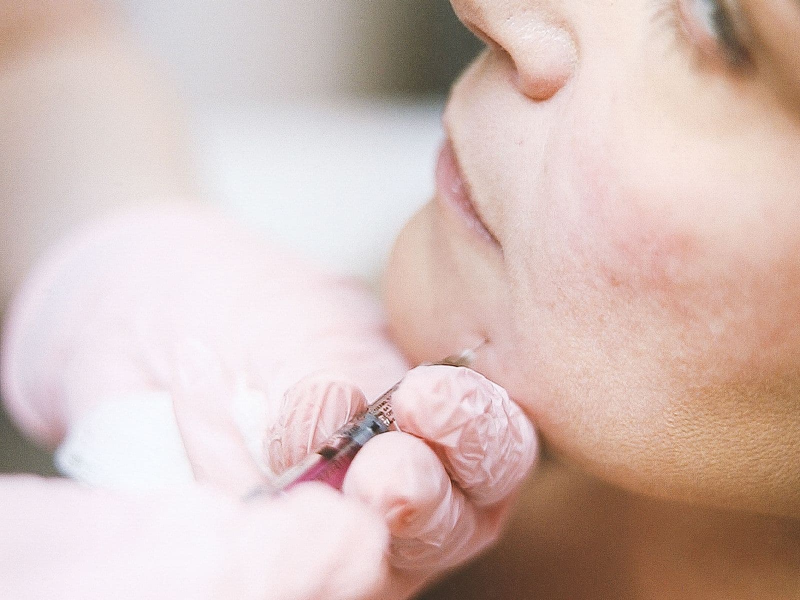 Microinyección ilustrativa durante un tratamiento facial