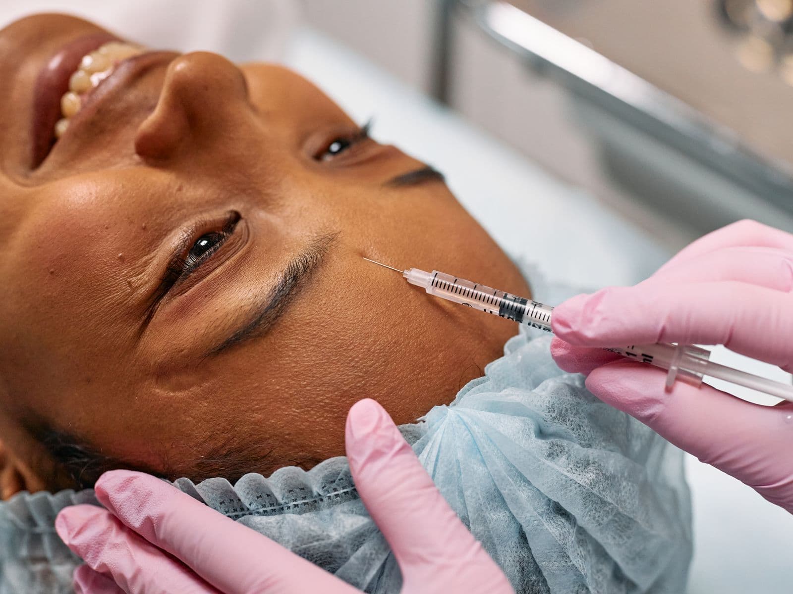 Aplicación facial ilustrativa de toxina botulínica