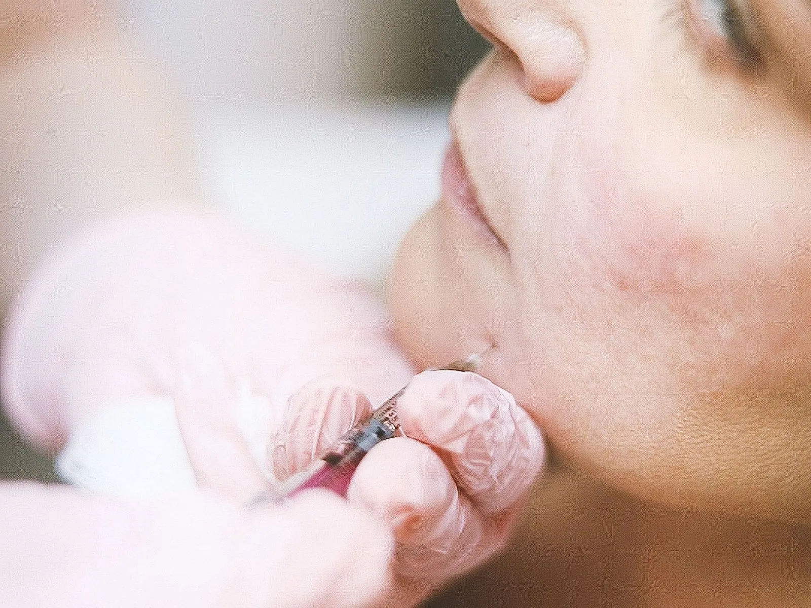 Microinyección ilustrativa durante un tratamiento facial